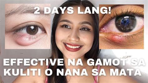 gamot sa nagluluha ang mata|Gamot Sa Nagluluhang Mata, Ayon Sa Doktor .